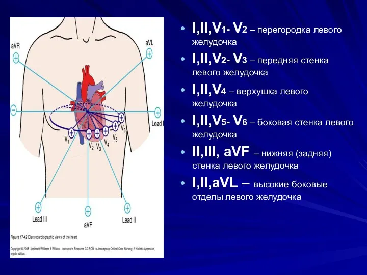 I,II,V1- V2 – перегородка левого желудочка I,II,V2- V3 – передняя стенка