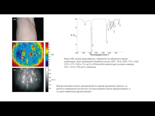 Флуоресцентный анализ, выполненный на правом предплечье Дэвида: (а) цветное изображение местности;