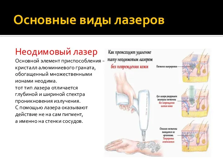 Основные виды лазеров Неодимовый лазер Основной элемент приспособления – кристалл алюминиевого