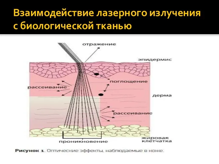 Взаимодействие лазерного излучения с биологической тканью