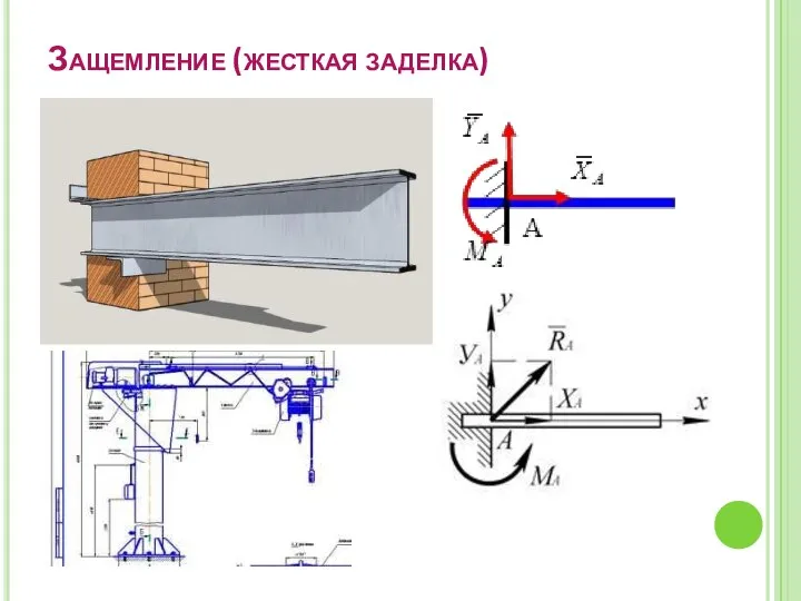 Защемление (жесткая заделка)