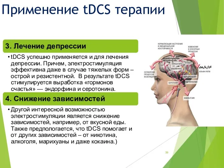 Применение tDCS терапии