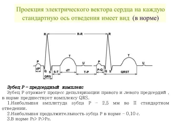 Зубец Р – предсердный комплекс Зубец Р отражает процесс деполяризации правого