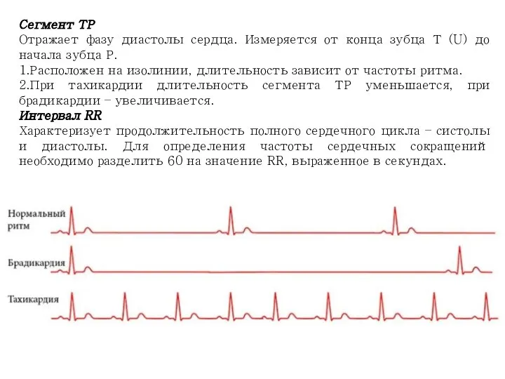 Сегмент ТР Отражает фазу диастолы сердца. Измеряется от конца зубца Т