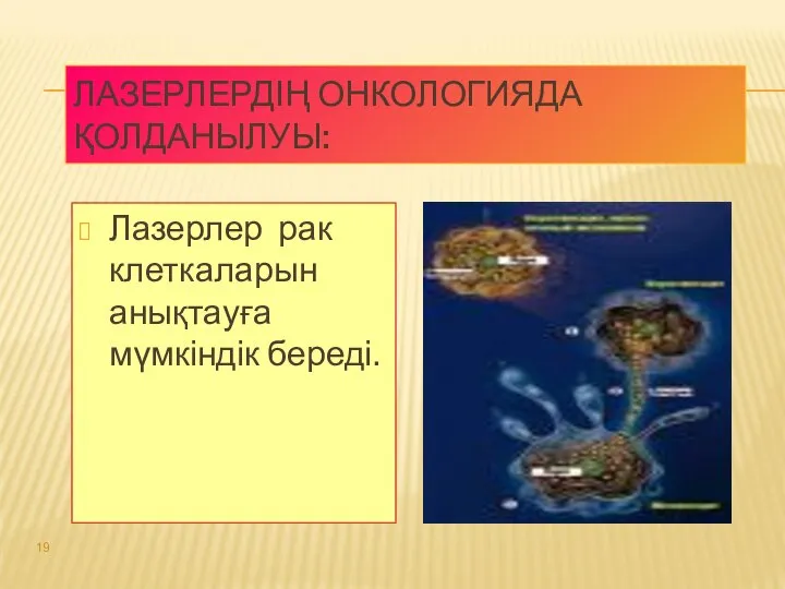 ЛАЗЕРЛЕРДІҢ ОНКОЛОГИЯДА ҚОЛДАНЫЛУЫ: Лазерлер рак клеткаларын анықтауға мүмкіндік береді.