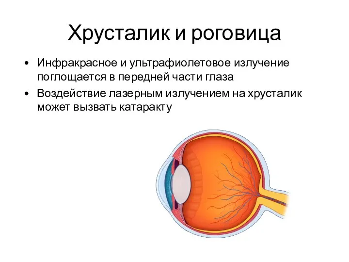 Хрусталик и роговица Инфракрасное и ультрафиолетовое излучение поглощается в передней части