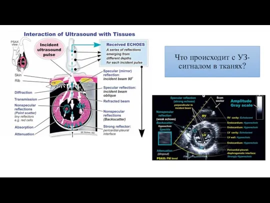 Что происходит с УЗ-сигналом в тканях?