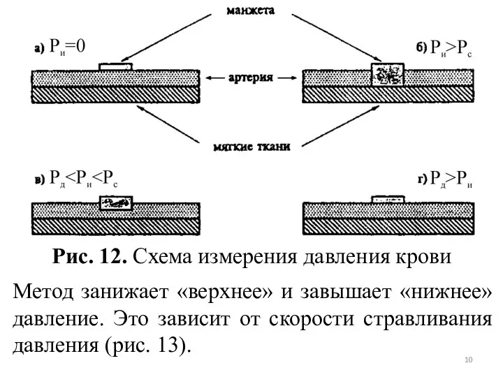 Рис. 12. Схема измерения давления крови Метод занижает «верхнее» и завышает