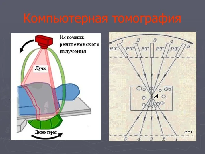 Компьютерная томография