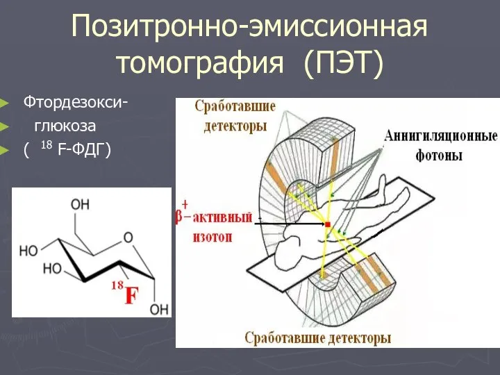 Позитронно-эмиссионная томография (ПЭТ) Фтордезокси- глюкоза ( 18 F-ФДГ)