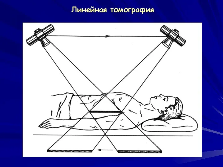 Линейная томография