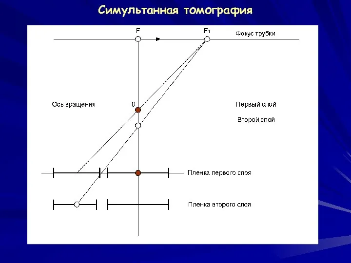 Симультанная томография