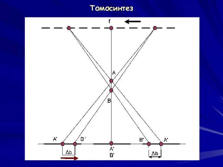 Томосинтез