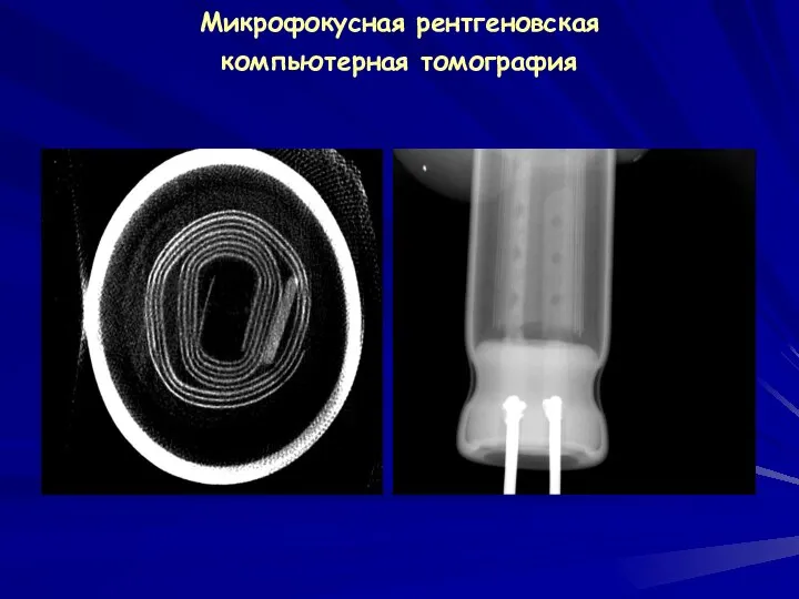 Микрофокусная рентгеновская компьютерная томография