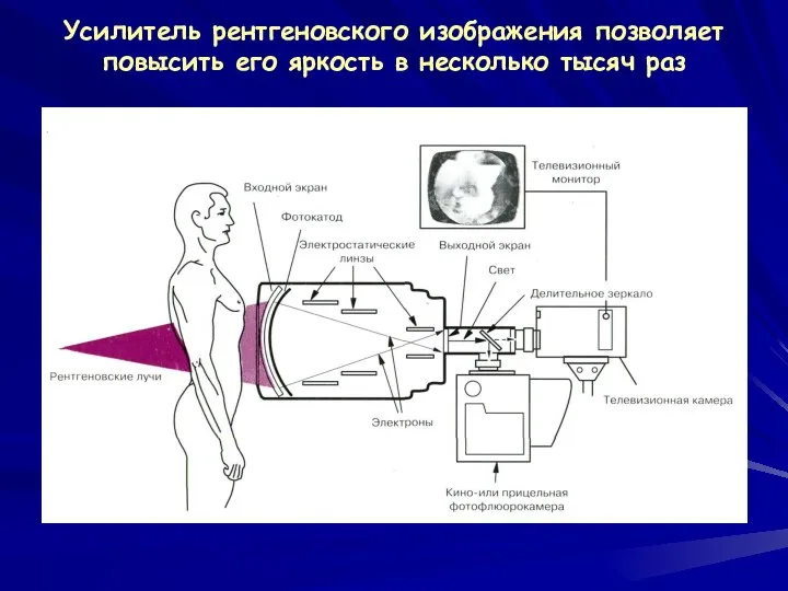 Усилитель рентгеновского изображения позволяет повысить его яркость в несколько тысяч раз