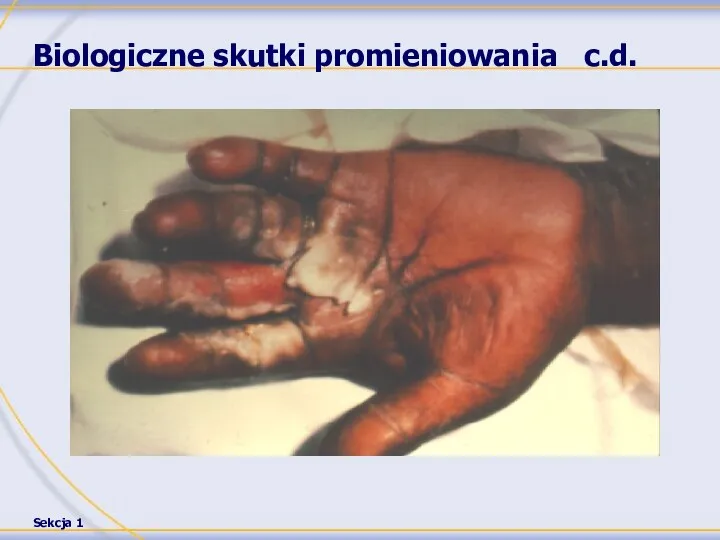 Biologiczne skutki promieniowania c.d.