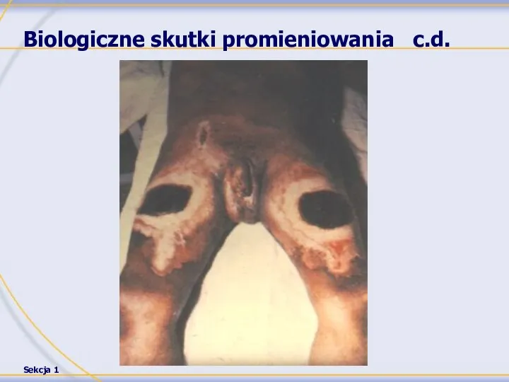 Biologiczne skutki promieniowania c.d.