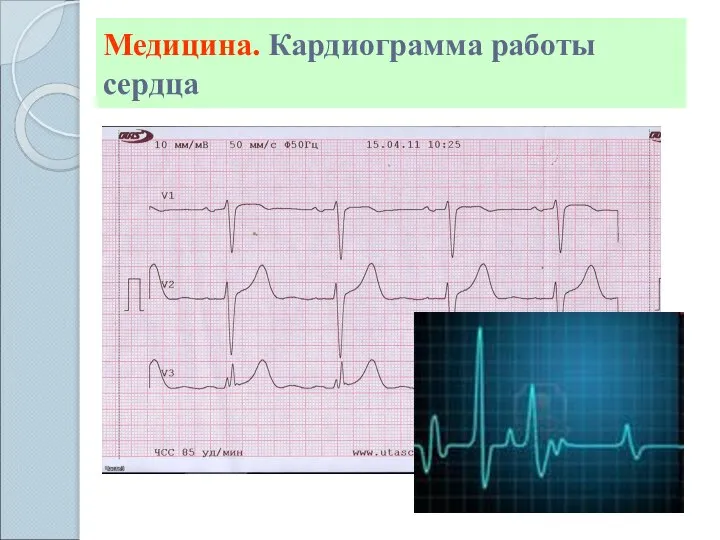 Медицина. Кардиограмма работы сердца