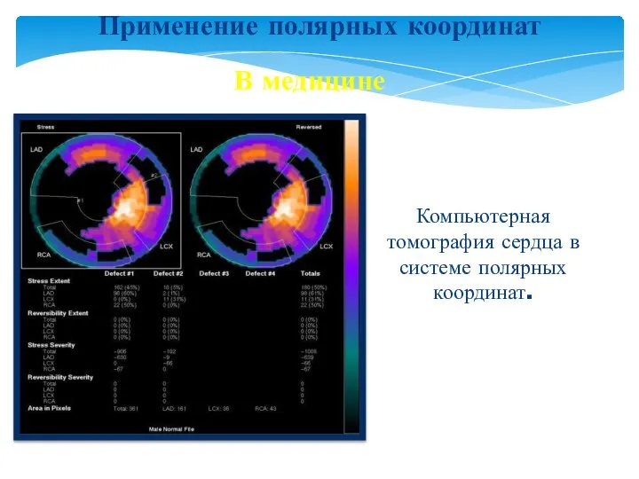 Применение полярных координат В медицине Компьютерная томография сердца в системе полярных координат.