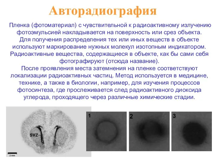 Авторадиография Пленка (фотоматериал) с чувствительной к радиоактивному излучению фотоэмульсией накладывается на