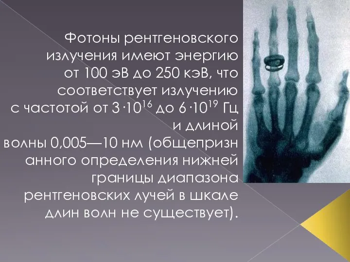 Фотоны рентгеновского излучения имеют энергию от 100 эВ до 250 кэВ,