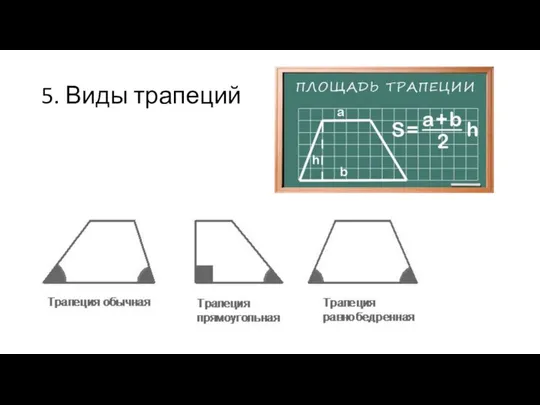 5. Виды трапеций