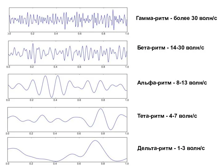 Дельта-ритм - 1-3 волн/c Гамма-ритм - более 30 волн/c Бета-ритм -