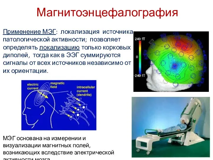 Магнитоэнцефалография Применение МЭГ: локализация источника патологической активности; позволяет определять локализацию только