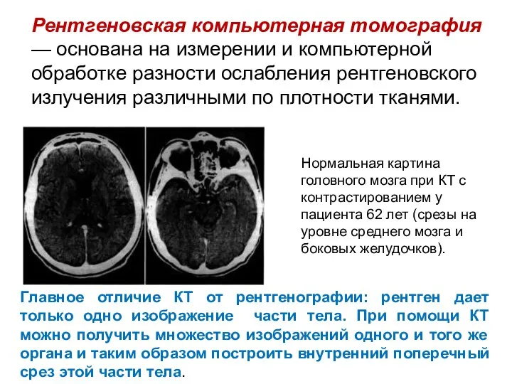 Рентгеновская компьютерная томография — основана на измерении и компьютерной обработке разности