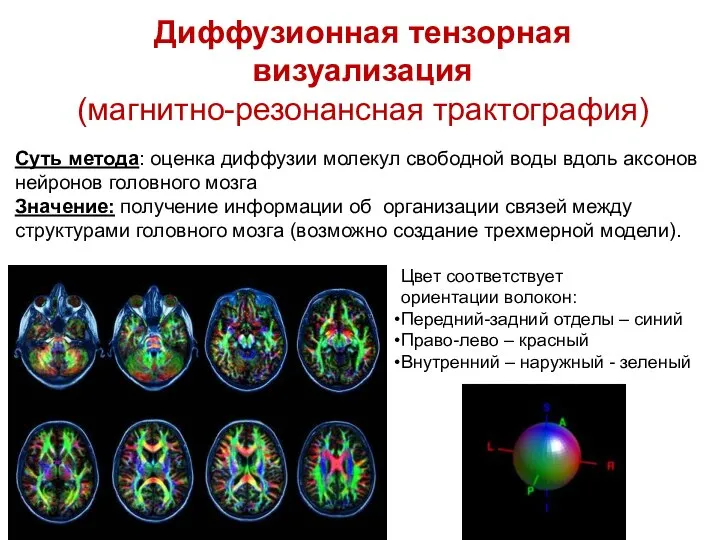 Суть метода: оценка диффузии молекул свободной воды вдоль аксонов нейронов головного