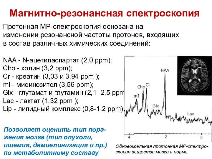 Магнитно-резонансная спектроскопия Протонная МР-спектроскопия основана на изменении резонансной частоты протонов, входящих