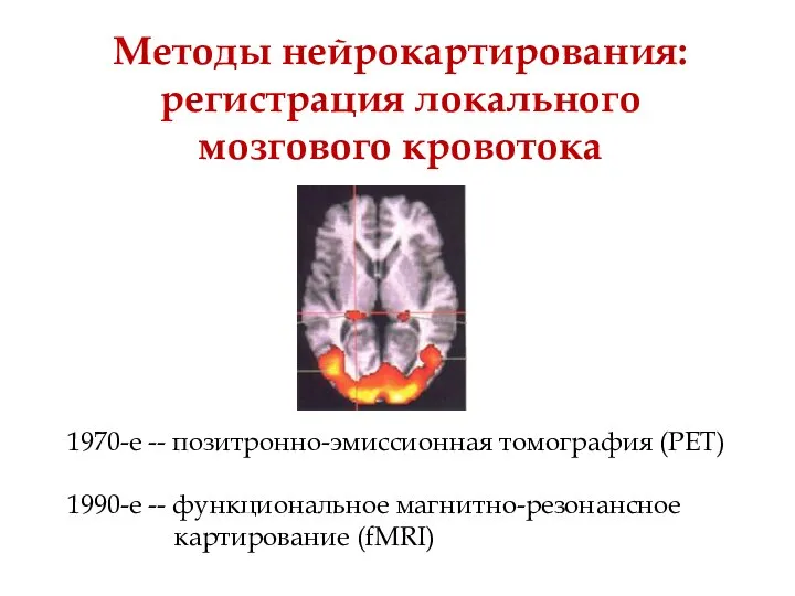 Методы нейрокартирования: регистрация локального мозгового кровотока 1970-е -- позитронно-эмиссионная томография (PET)
