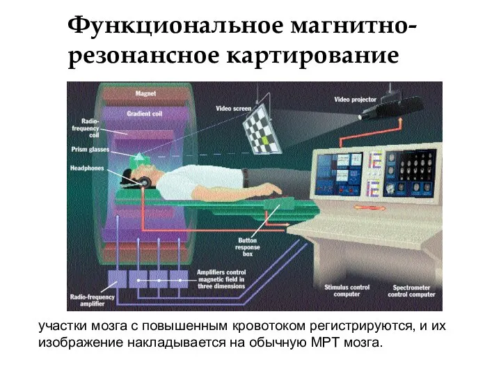 Функциональное магнитно-резонансное картирование участки мозга с повышенным кровотоком регистрируются, и их