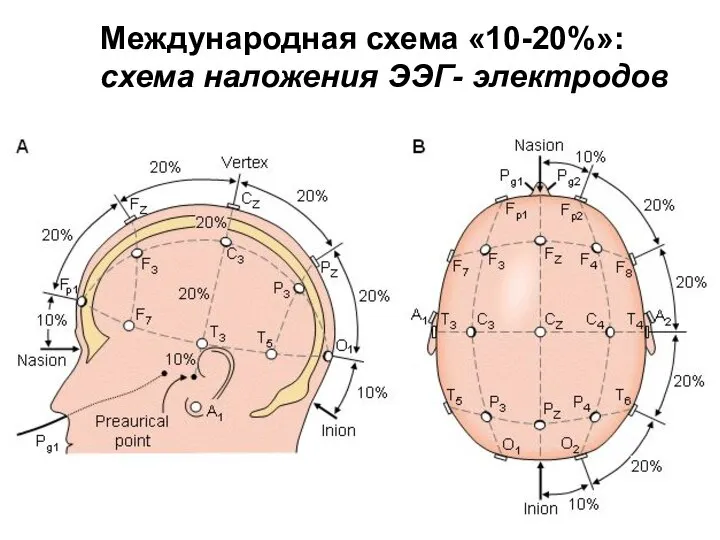 Международная схема «10-20%»: схема наложения ЭЭГ- электродов