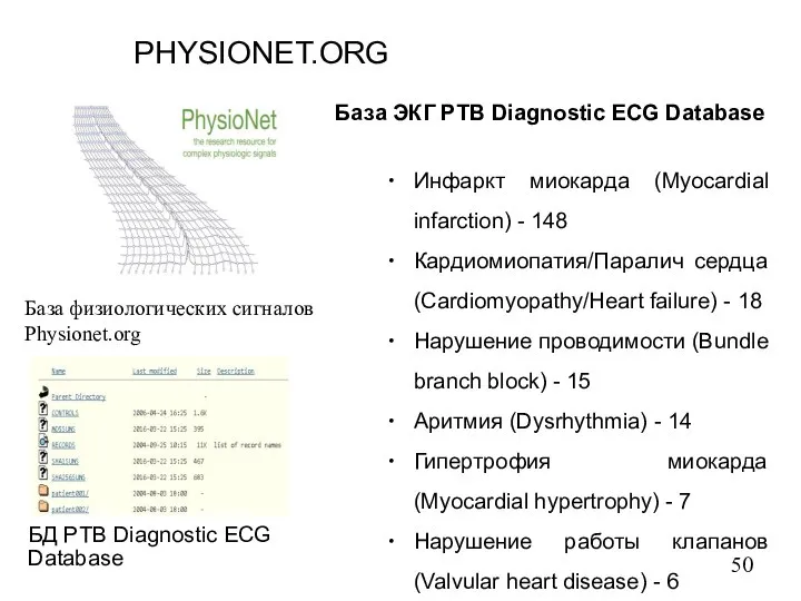 PHYSIONET.ORG База физиологических сигналов Physionet.org БД PTB Diagnostic ECG Database База