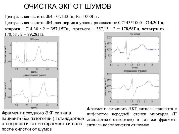 ОЧИСТКА ЭКГ ОТ ШУМОВ Центральная частота db4 - 0,7143Гц, Fд=1000Гц .