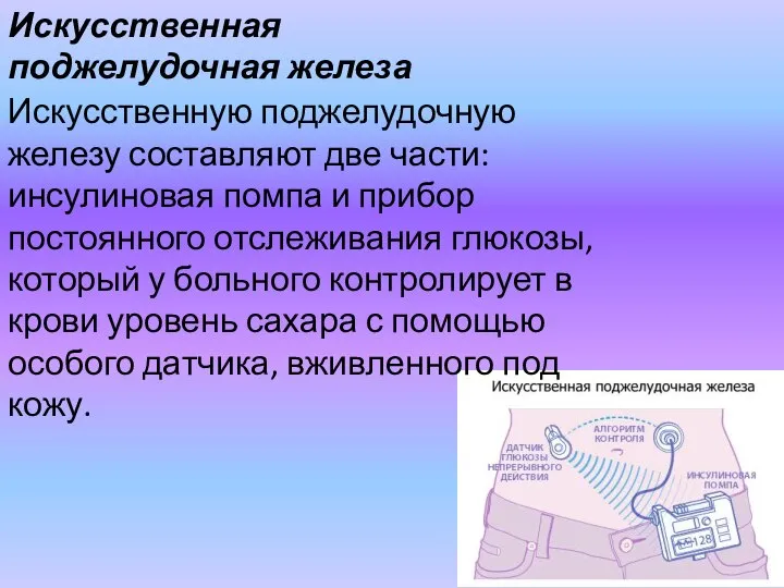 Искусственную поджелудочную железу составляют две части: инсулиновая помпа и прибор постоянного