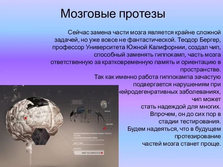 Мозговые протезы Сейчас замена части мозга является крайне сложной задачей, но