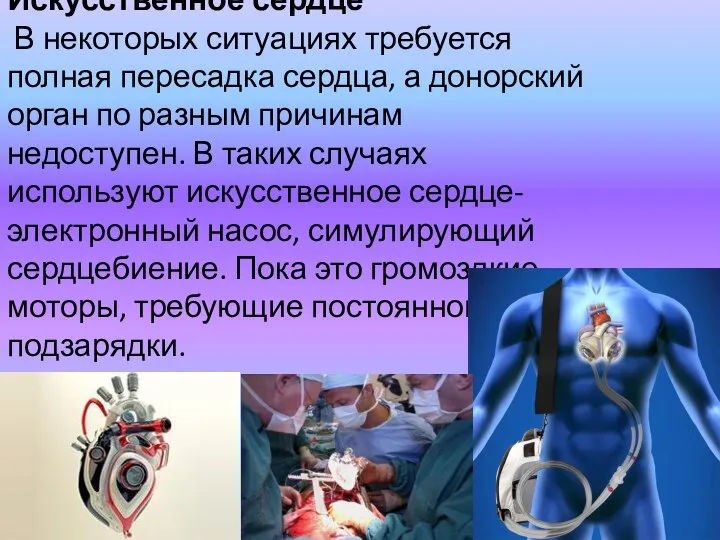 Искусственное сердце В некоторых ситуациях требуется полная пересадка сердца, а донорский