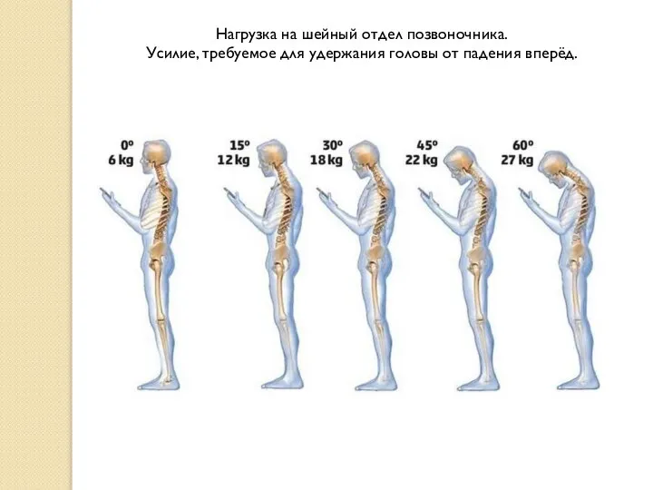 Нагрузка на шейный отдел позвоночника. Усилие, требуемое для удержания головы от падения вперёд.