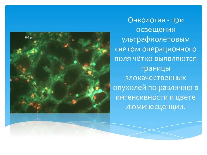 Онкология - при освещении ультрафиолетовым светом операционного поля чётко выявляются границы