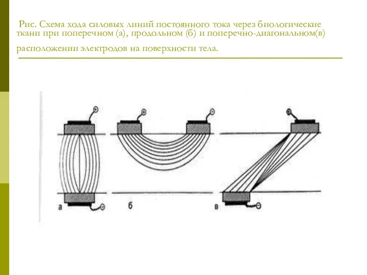 Рис. Схема хода силовых линий постоянного тока через биологические ткани при