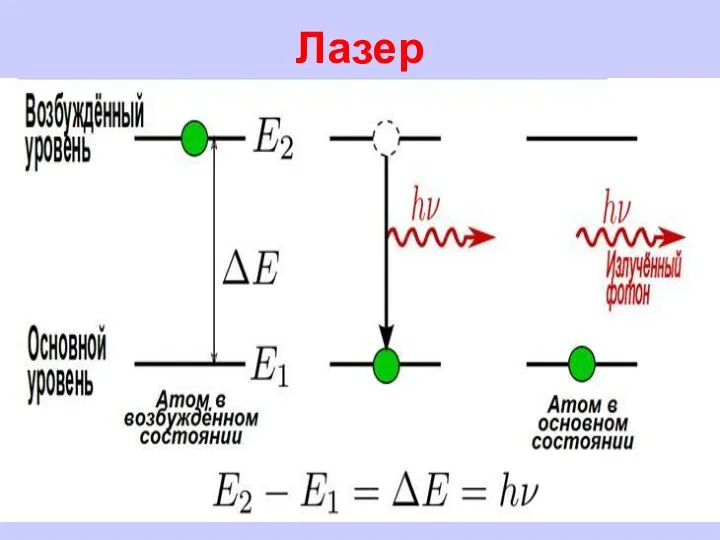 Лазер