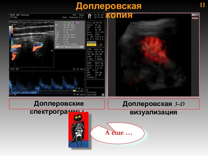 11 Доплеровские спектрограммы Доплеровская эхоскопия Доплеровская 3-D визуализация