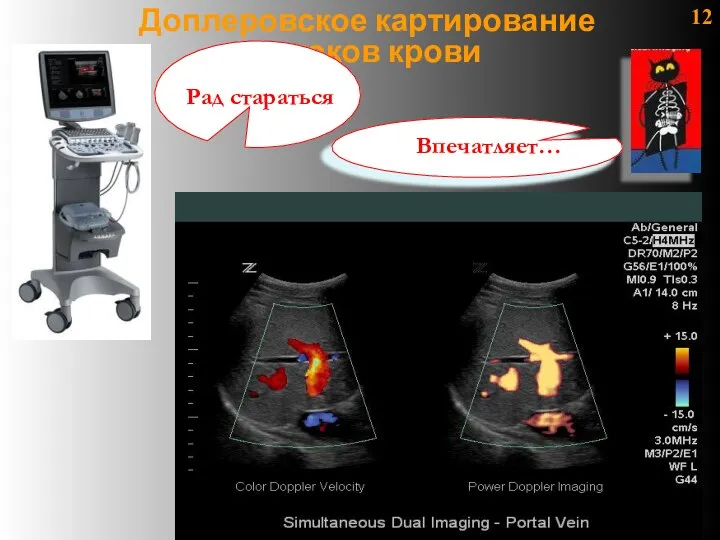 12 Доплеровское картирование потоков крови