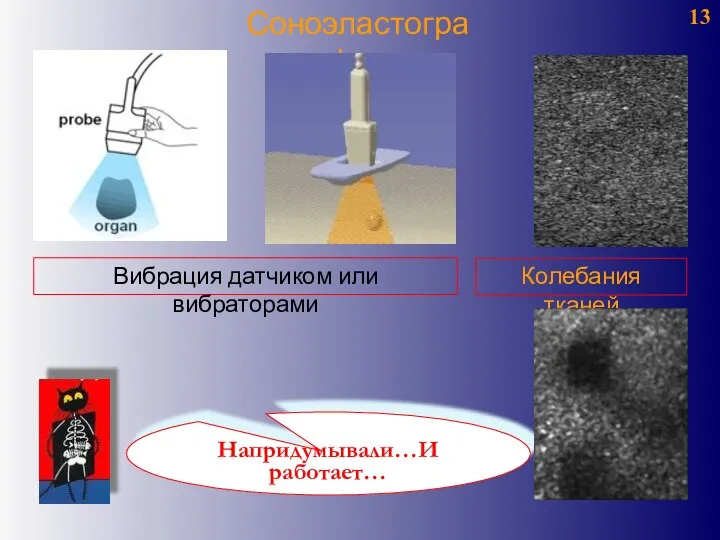 13 Соноэластография Колебания тканей Вибрация датчиком или вибраторами