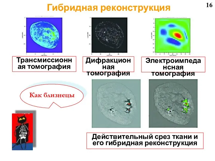 16 Трансмиссионная томография Дифракционная томография Электроимпедансная томография Действительный срез ткани и его гибридная реконструкция Гибридная реконструкция