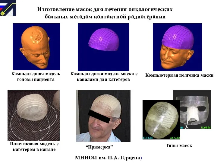 Компьютерная модель головы пациента Компьютерная модель маски с каналами для катетеров