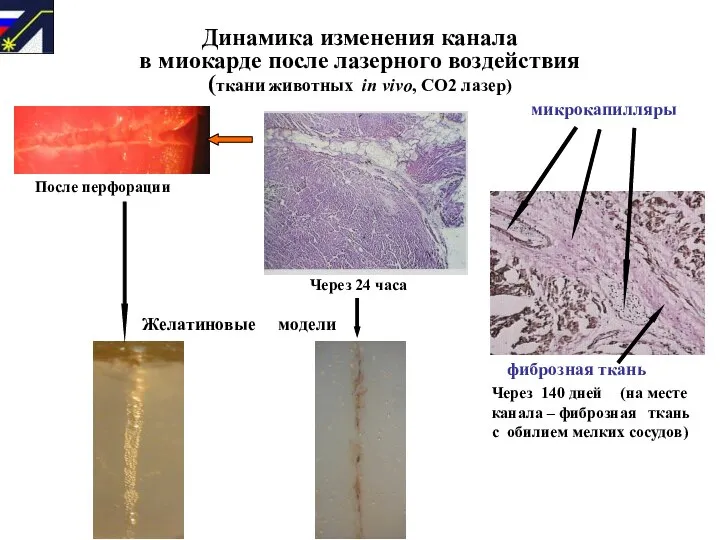 Динамика изменения канала в миокарде после лазерного воздействия (ткани животных in