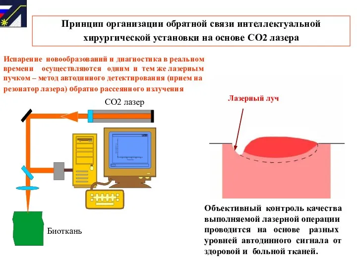 Принцип организации обратной связи интеллектуальной хирургической установки на основе СО2 лазера